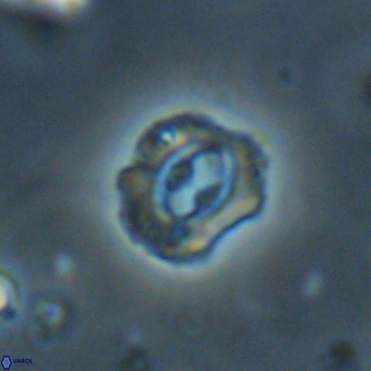 Cruciplacolithus latipons 69239