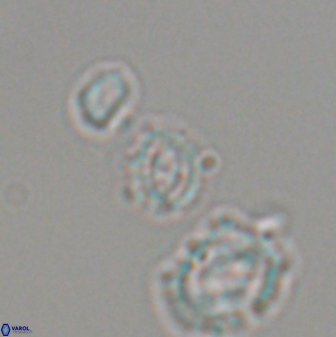 Cruciplacolithus primus 22851