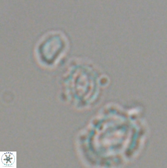 Cruciplacolithus primus 22851