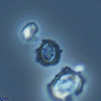 Cruciplacolithus primus 22852