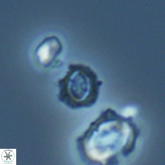 Cruciplacolithus primus 22852