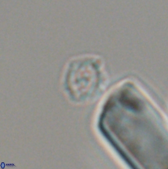 Cruciplacolithus primus 22893