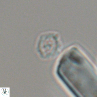 Cruciplacolithus primus 22893