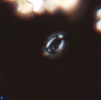 Cruciplacolithus primus 24159