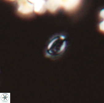 Cruciplacolithus primus 24159