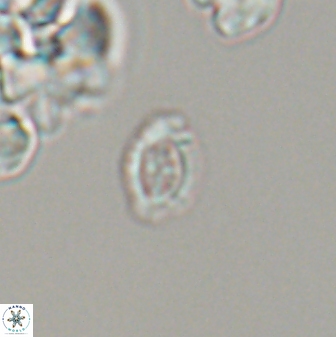 Cruciplacolithus primus 24161