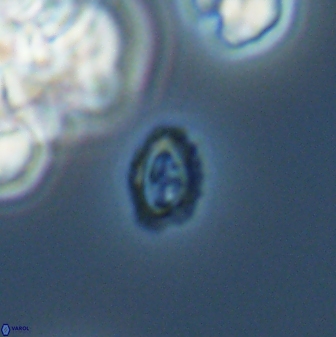 Cruciplacolithus primus 24162