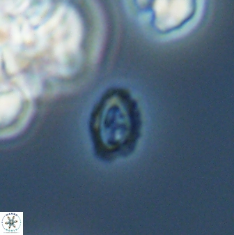 Cruciplacolithus primus 24162