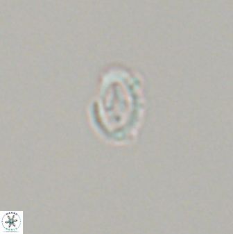 Cruciplacolithus primus 24171