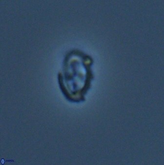 Cruciplacolithus primus 24172