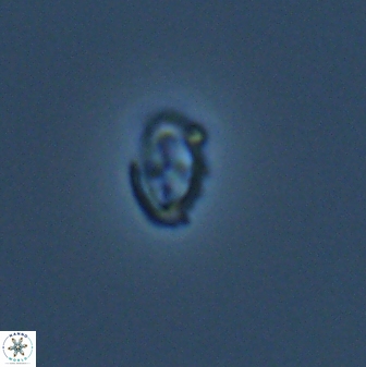 Cruciplacolithus primus 24172