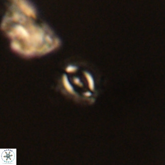 Cruciplacolithus primus VR 01187
