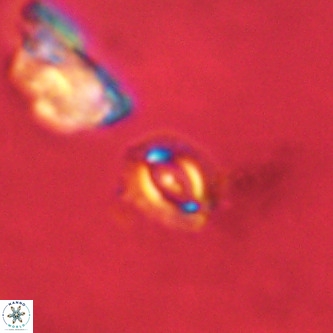 Cruciplacolithus primus VR 01188