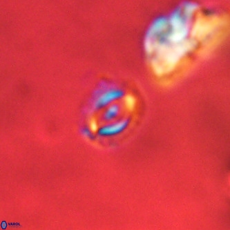 Cruciplacolithus primus VR 01189