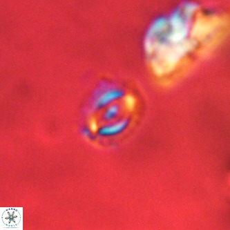 Cruciplacolithus primus VR 01189