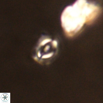 Cruciplacolithus primus VR 01190