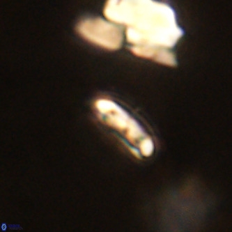 Cruciplacolithus primus VR 01191