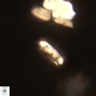 Cruciplacolithus primus VR 01191