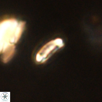 Cruciplacolithus primus VR 01199