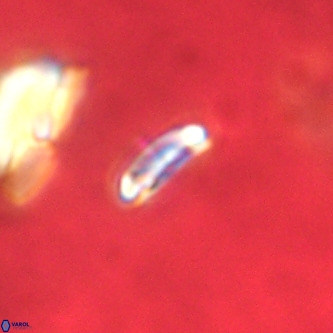 Cruciplacolithus primus VR 01200