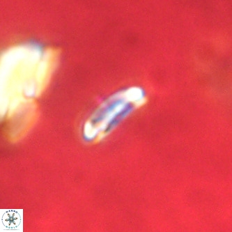 Cruciplacolithus primus VR 01200