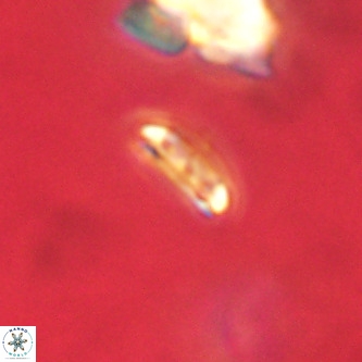 Cruciplacolithus primus VR 01205