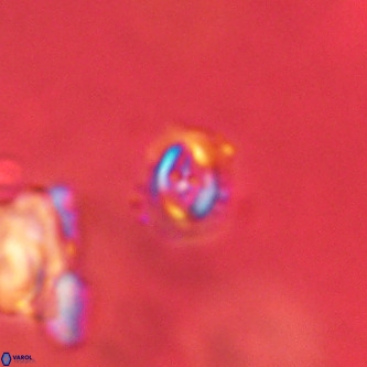 Cruciplacolithus primus VR 01214