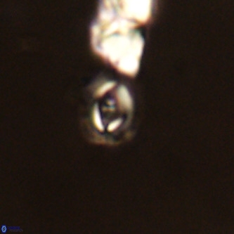 Cruciplacolithus primus VR 01218