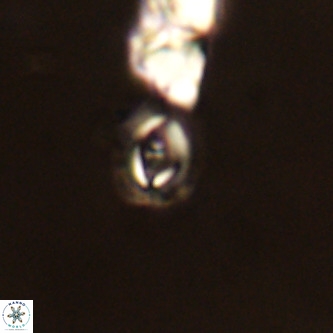 Cruciplacolithus primus VR 01218
