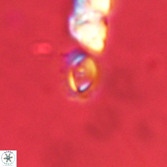 Cruciplacolithus primus VR 01220