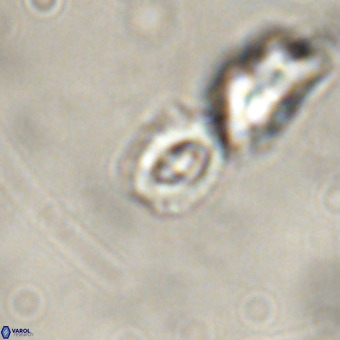 Cruciplacolithus primus VR 01221