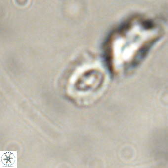 Cruciplacolithus primus VR 01221
