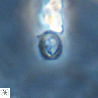 Cruciplacolithus primus VR 01224
