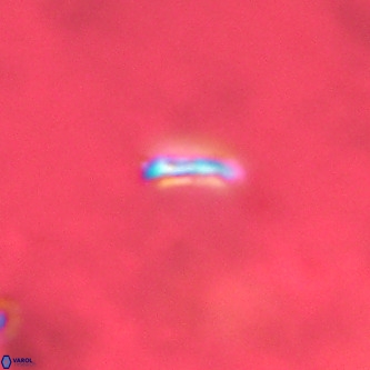 Cruciplacolithus primus VR 01399