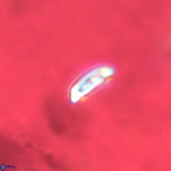 Cruciplacolithus primus VR 01400