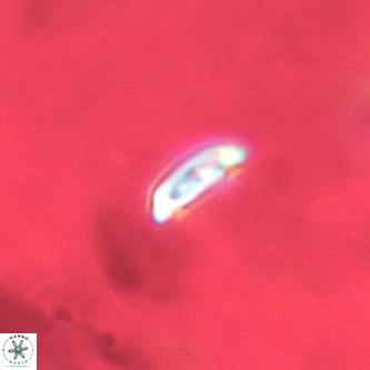 Cruciplacolithus primus VR 01400