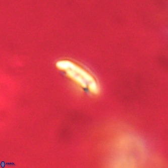 Cruciplacolithus primus VR 01404