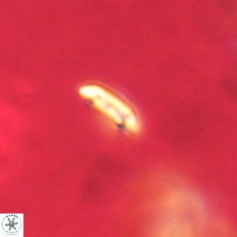 Cruciplacolithus primus VR 01404
