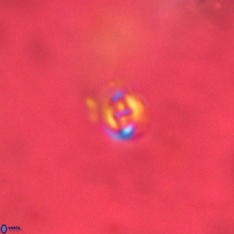 Cruciplacolithus primus VR 01415