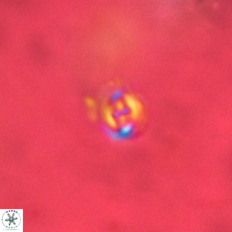 Cruciplacolithus primus VR 01415