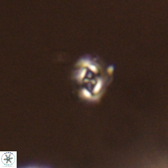 Cruciplacolithus primus VR 01420