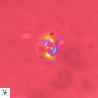 Cruciplacolithus primus VR 01421