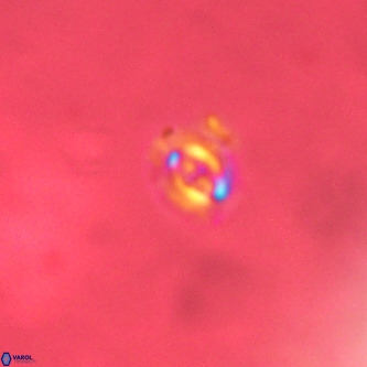 Cruciplacolithus primus VR 01423