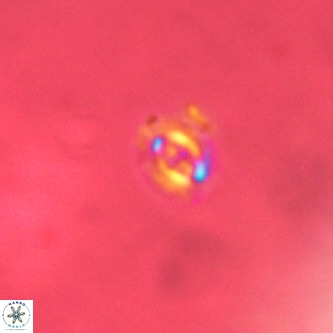 Cruciplacolithus primus VR 01423