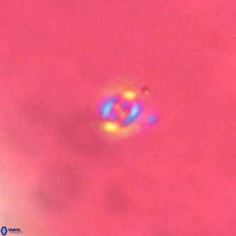 Cruciplacolithus primus VR 01425