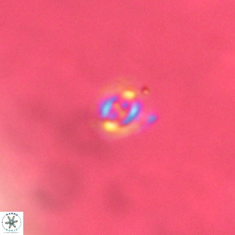 Cruciplacolithus primus VR 01425