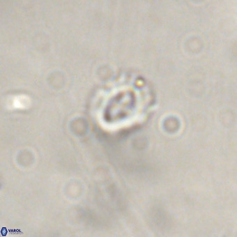 Cruciplacolithus primus VR 01433