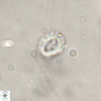 Cruciplacolithus primus VR 01433