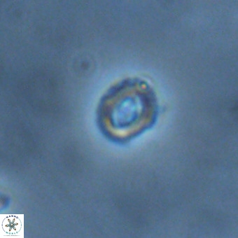 Cruciplacolithus primus VR 01437