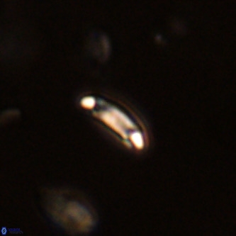 Cruciplacolithus primus VR 01740